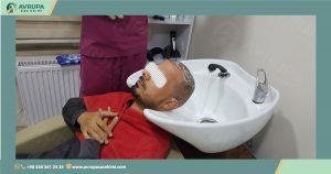 اضرار زراعة الشعر