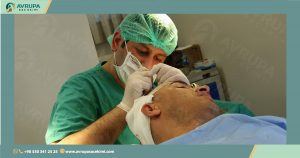 زراعة الشعر في تركيا best hair transplant center in Turkey,best hair transplant clinic Turkey