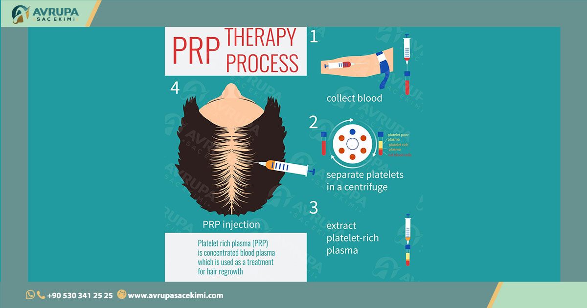 P.R.P Therapy for Hair Loss