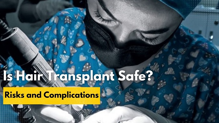is hair transplant safe