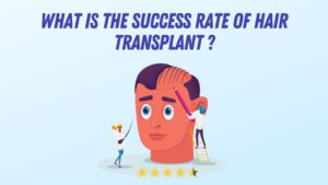 success rate of hair transplant