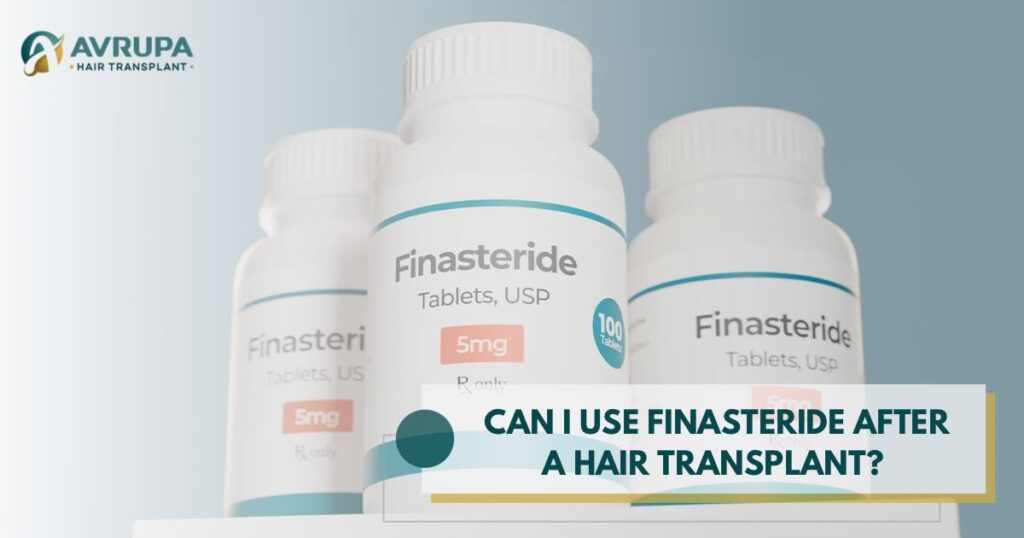 Finasteride After Hair Transplant: Do I Have to Take It?